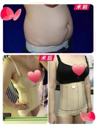 -广东韩妃整形外科医院