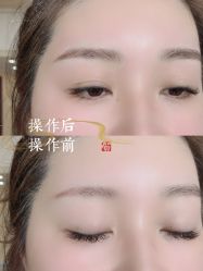 -西施无菌半永久纹绣眉眼影唇轻增发纹发际线