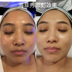 -安吉拉青春化管理中心