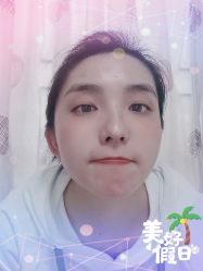 -大麦微针植发全国连锁