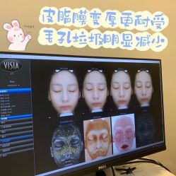 -安吉拉青春化管理中心