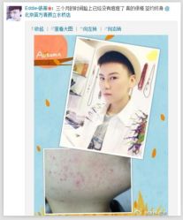 QQ截图20130607130209-苗方清颜专业祛痘