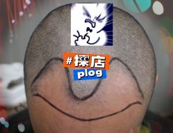 -大麦微针植发全国连锁