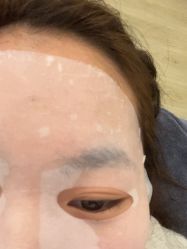 体验后-杭州美莱医疗美容医院