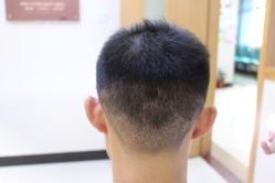 -大麦微针植发丨全国连锁