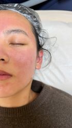 -长沙雅美医疗美容医院