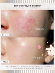 -skin79皮肤管理中心