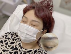 点击看大图 -YIMEI ART半永久纹眉·野生眉