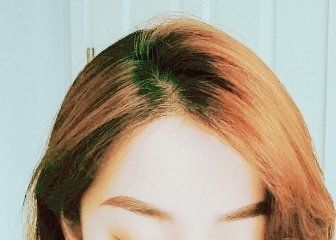 -大麦微针植发丨全国连锁
