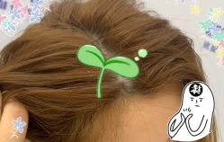 -大麦微针植发全国连锁