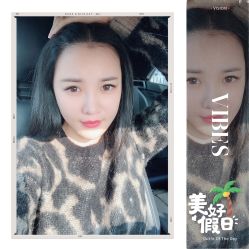 -大麦微针植发全国连锁
