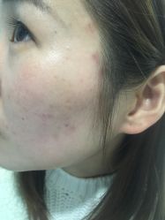 -芙贝佳禾·痘肌管理中心