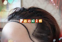 -大麦微针植发全国连锁