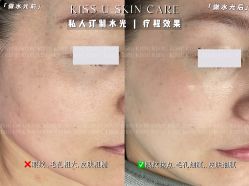 -KISS U 国际美学