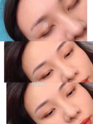 点击看大图 -久匠半永久纹眉