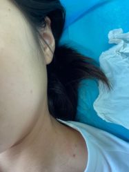 -美丽人生祛斑扁平疣汗管瘤中心