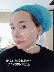 体验后-广东韩妃整形外科医院