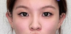 -广州曙光医学美容医院