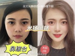 -北京米扬丽格医疗美容·联合丽格鼻整形中心