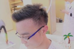 -大麦微针植发全国连锁