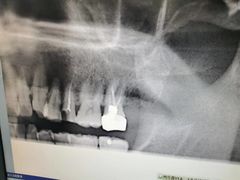 -上海市杨浦区牙病防治所