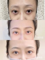 -久匠·纹眉纹绣半永久