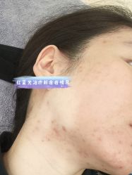 点击看大图 -成都艾特他整形外科医院
