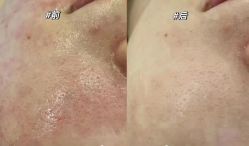 -Cream88颜皮肤管理中心