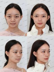 -Yestar艺星医疗美容医院