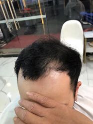 -发饰美男士增发补发假发定制店