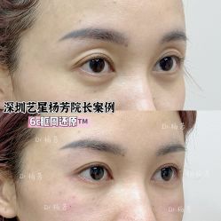 -深圳艺星医疗美容医院
