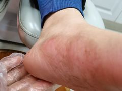 -新甲连锁灰指甲·甲沟炎·鸡眼(黑龙江路店)