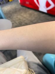 体验前-上海玫瑰医疗美容医院