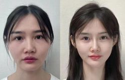 -Yestar 嘉兴艺星医疗美容医院