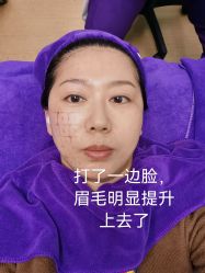 体验前-美莱医学美容医院