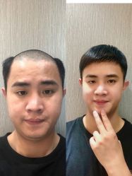 -发饰美男士增发补发假发定制店