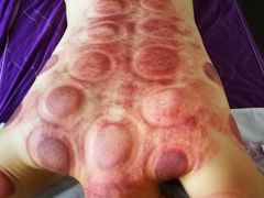 -顺则昌推按正骨理疗