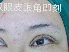 -苏州大学理想眼科医院