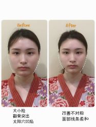-SEAS小顏·日本小颜整骨美容サロン
