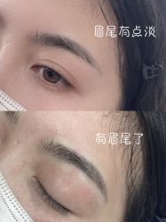 点击看大图 -张小野·专业半永久纹眉