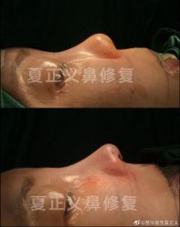-北京米扬丽格医疗美容·联合丽格鼻整形中心