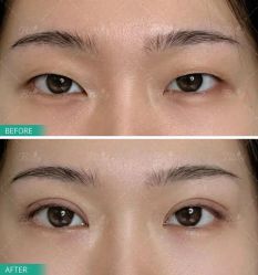 -尊尚柏丽美容SPA