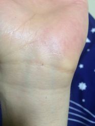 -咪咪比基尼脱毛专业店