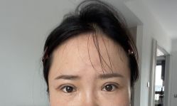 体验后-Dr.U博士医疗美容医院