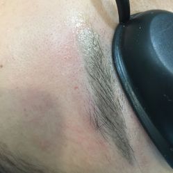 -郡艺医疗美容·微整·眼鼻吸脂