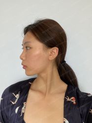 体验前-上海首尔丽格医疗美容医院