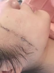 -薇兰专业脱毛连锁机构