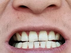 -微笑牙科口腔(三亚迎宾院区)