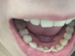 -Dr.Z dental仁康种植矫正中心