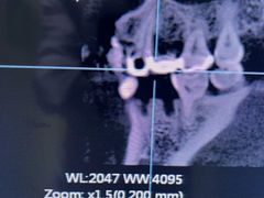 -爱贝口腔·牙周诊疗·种植修复中心